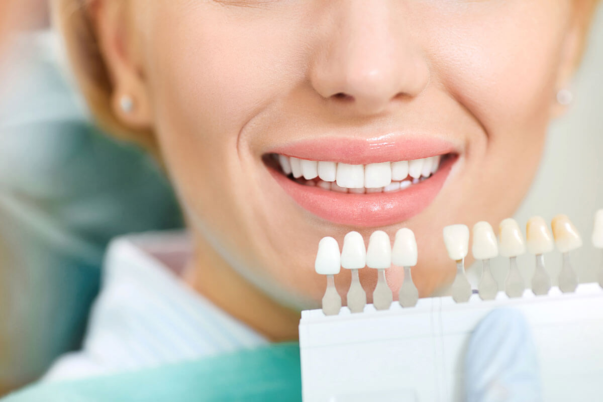 Natural-looking veneers and smile design at Dr. Hamarneh Dental Center
