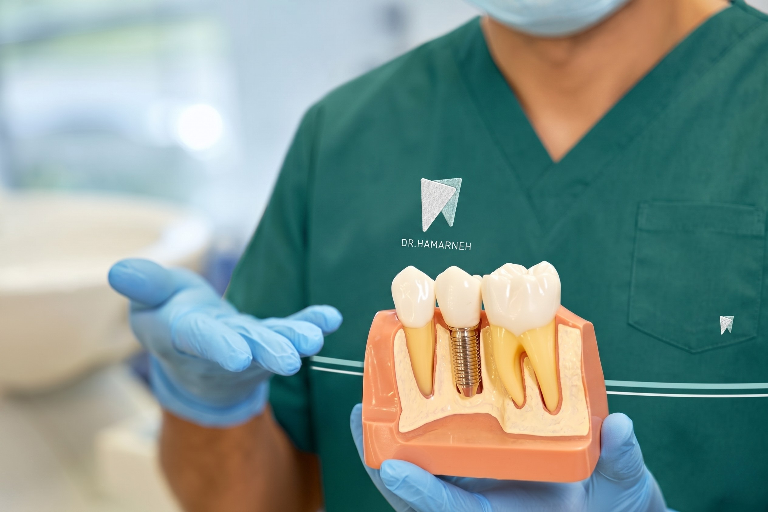 Dental implant model and treatment planning at Dr. Hamarneh Dental Center