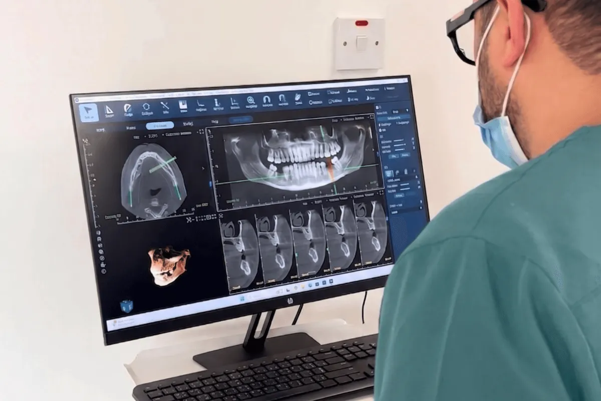 Dentist reviewing a CBCT dental scan in 3D on screen at a clinic in Khalda