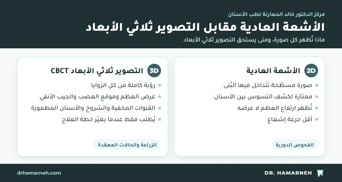 التصوير ثلاثي الأبعاد للأسنان CBCT مقارنة بالأشعة العادية ثنائية الأبعاد