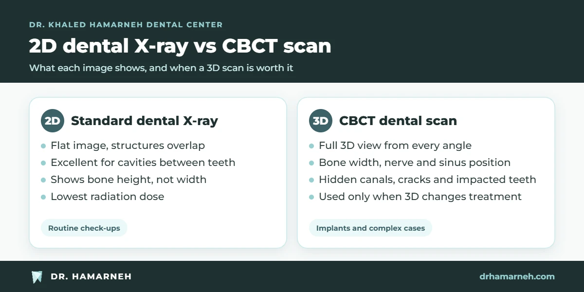 CBCT dental scan compared with a 2D dental X-ray: what 3D dental imaging shows