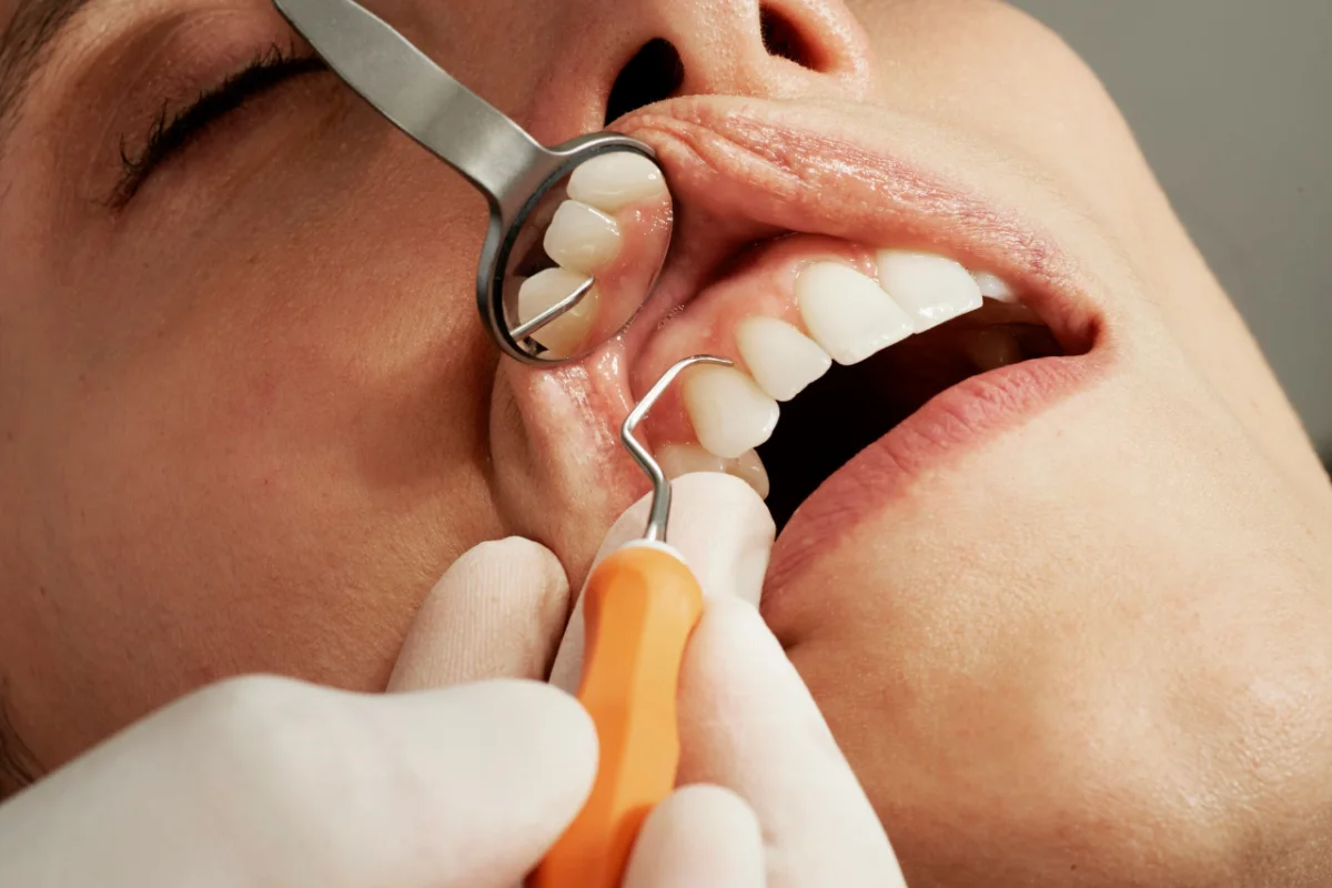 Dental examination before guided biofilm therapy teeth cleaning in Khalda