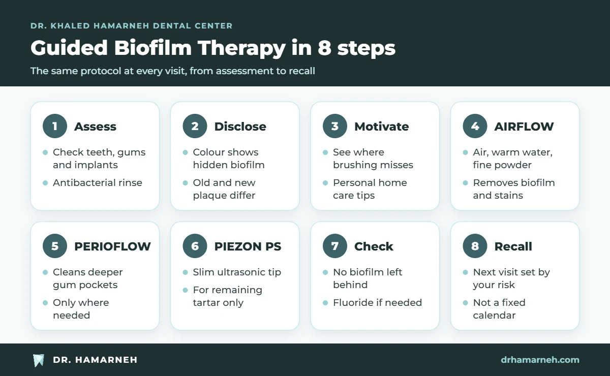 The 8 steps of guided biofilm therapy GBT teeth cleaning