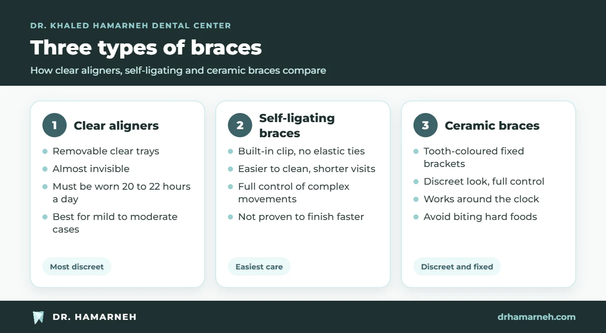 Types of braces compared: clear aligners, self-ligating braces and ceramic braces